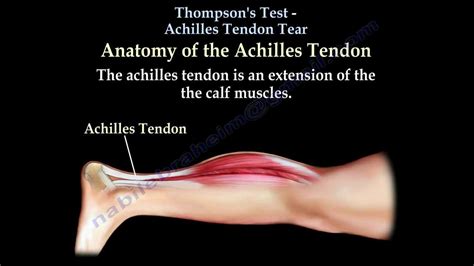 thompson test achilles tear|thompson test positive means.